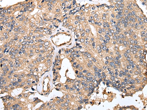 TESC Antibody