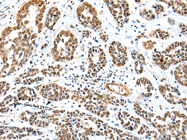 TWSG1 Antibody