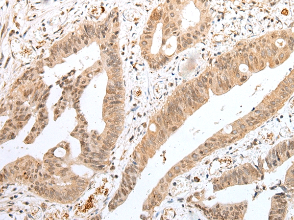 TWSG1 Antibody