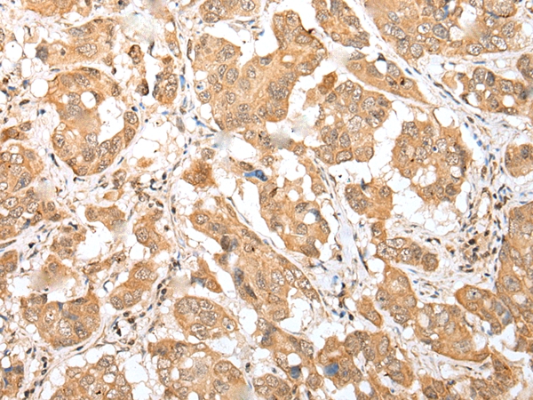 DNAJB9 Antibody