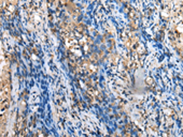 MOB4 Antibody