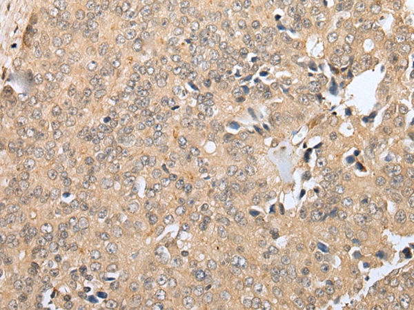 RNF114 Antibody