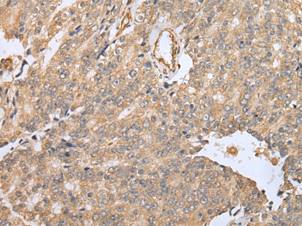 EBI3 Antibody