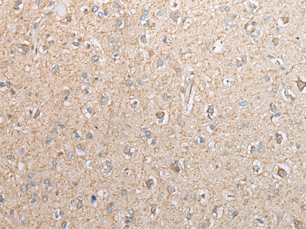 EBI3 Antibody