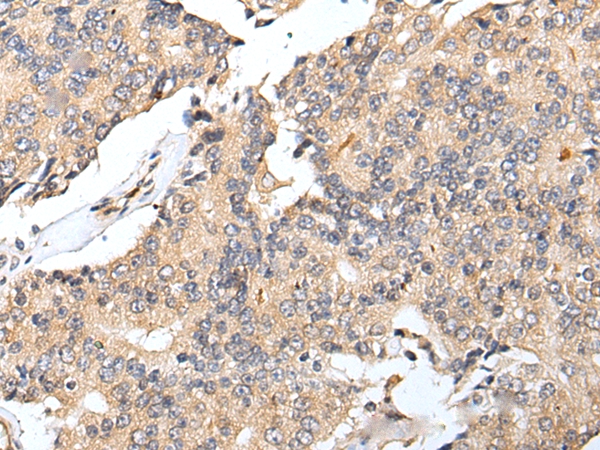 RNF141 Antibody