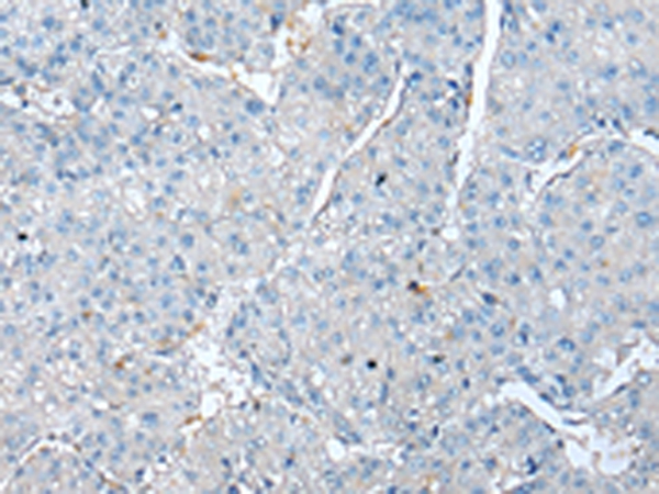 TPM4 Antibody