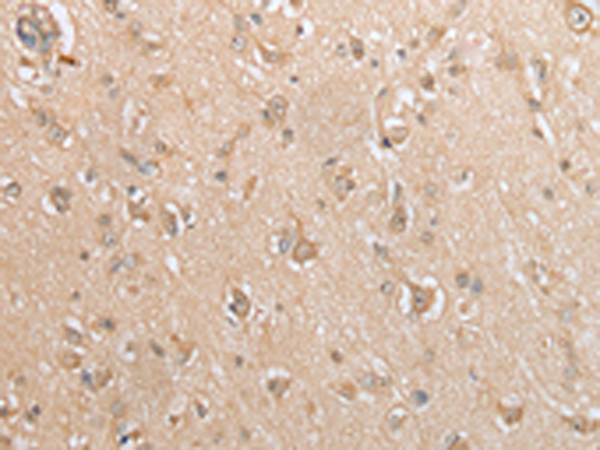 GCLC Antibody