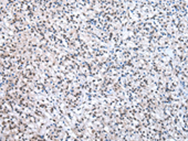 U2AF2 Antibody