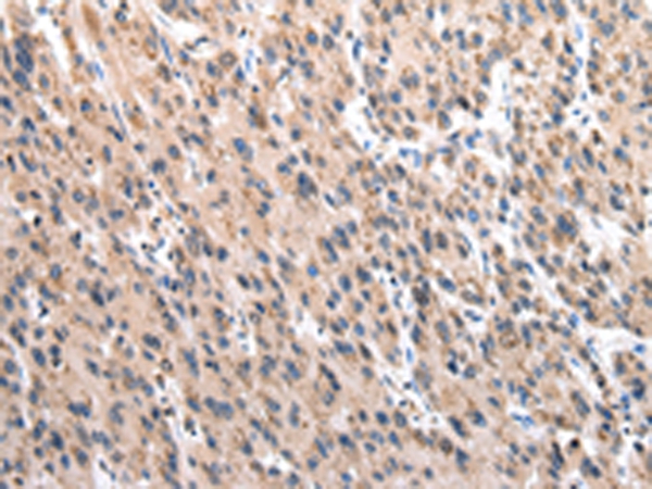 TCP1 Antibody