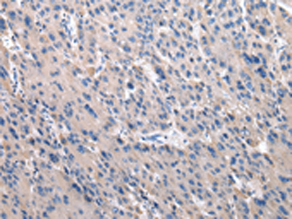 TOR1A Antibody