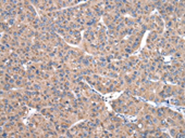 CASK Antibody