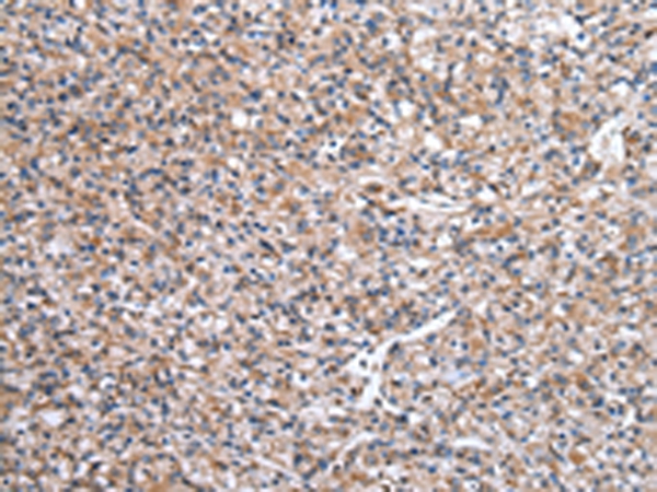 WASL Antibody