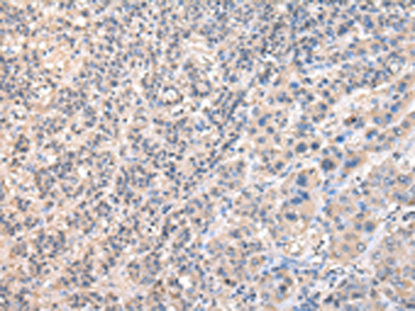 RUVBL1 Antibody