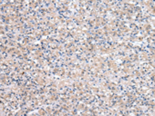 QDPR Antibody
