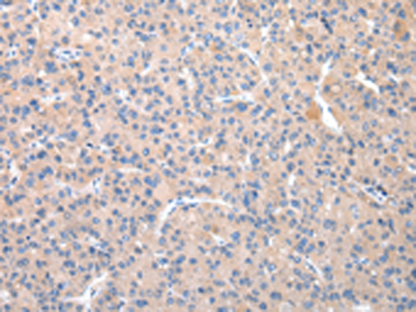 TCN2 Antibody