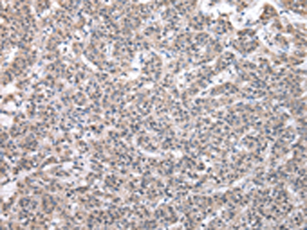 SBDS Antibody