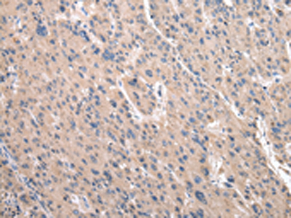 RPS10 Antibody