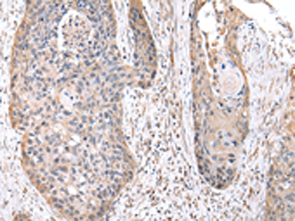 RPS10 Antibody