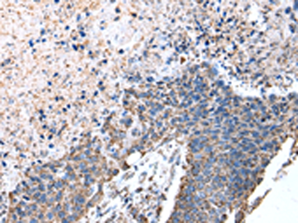 ATP5A1 Antibody