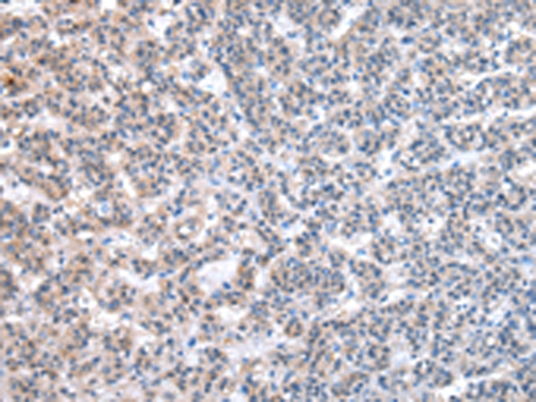 ESD Antibody