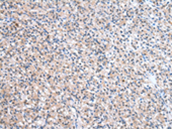 ESD Antibody