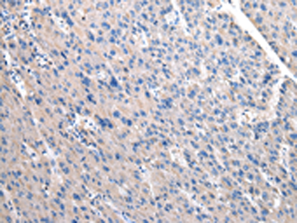 OAT Antibody