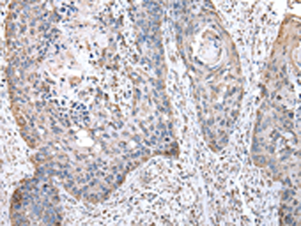 OAT Antibody