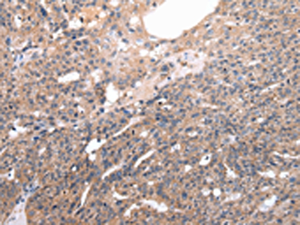 M6PR Antibody