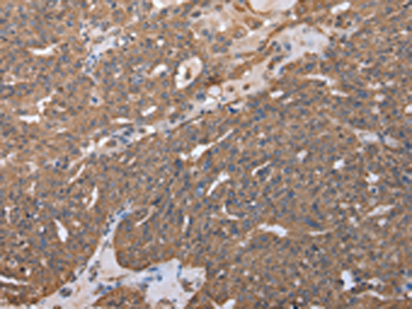RARS Antibody