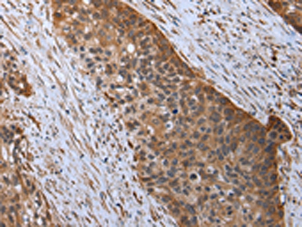 RARS Antibody