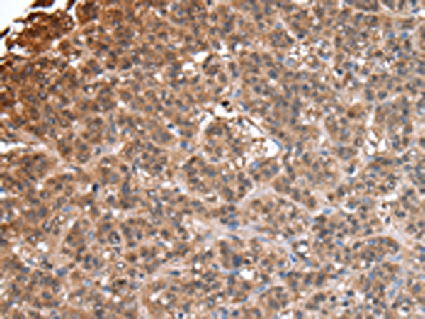 IMPA1 Antibody