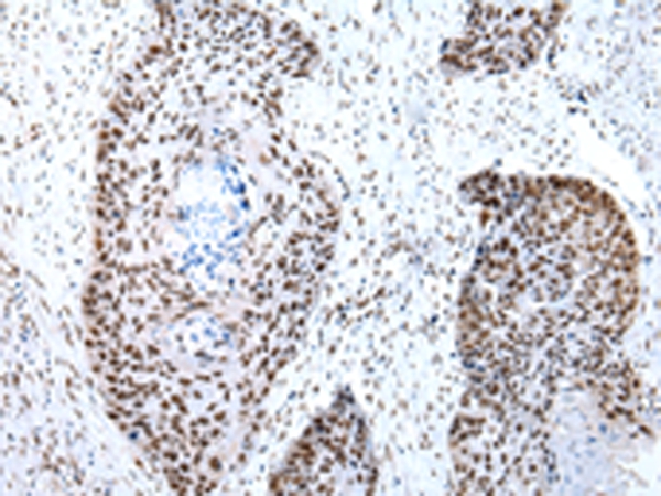 SNRPA Antibody