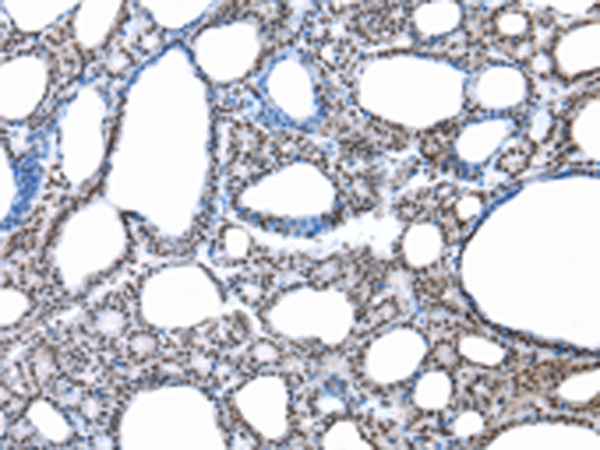 SNRPA Antibody