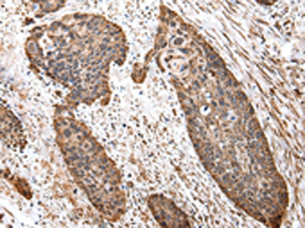 TUFM Antibody