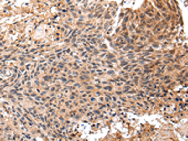 SF1 Antibody