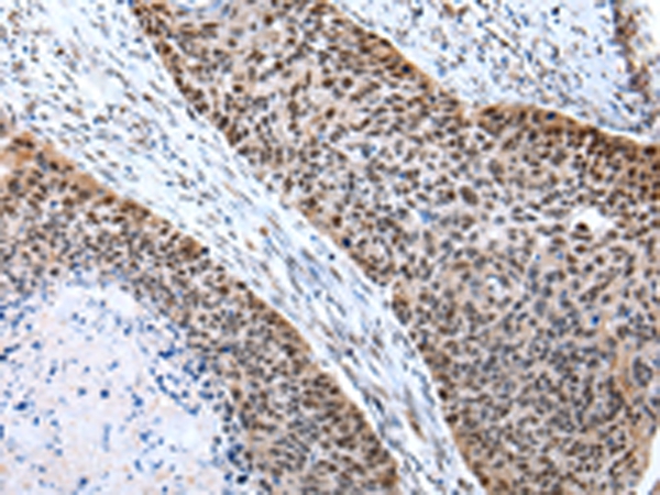 POLE3 Antibody
