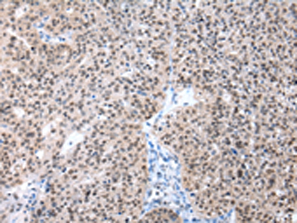 POLE3 Antibody