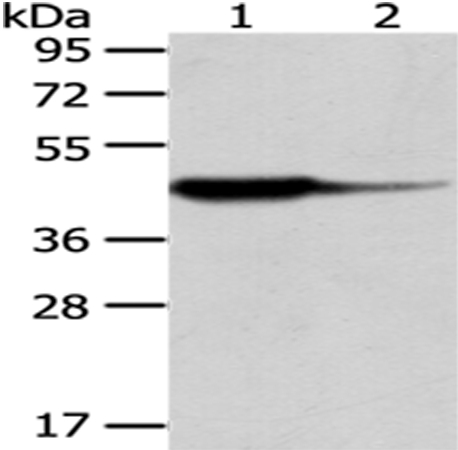 HAO1 Antibody
