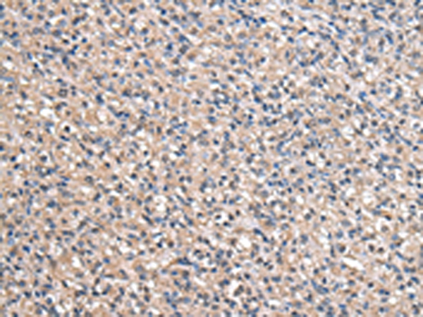 ACSS2 Antibody