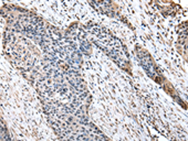 HPD Antibody