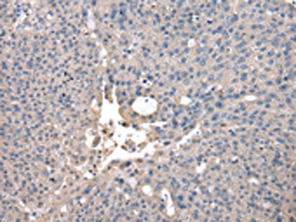 CCT2 Antibody