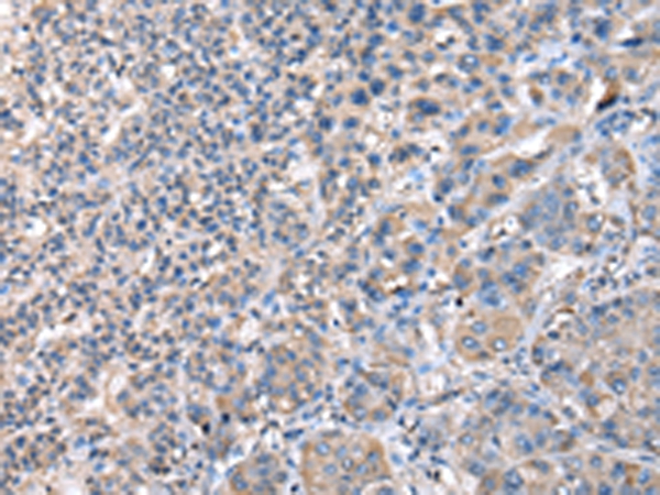 CCT4 Antibody