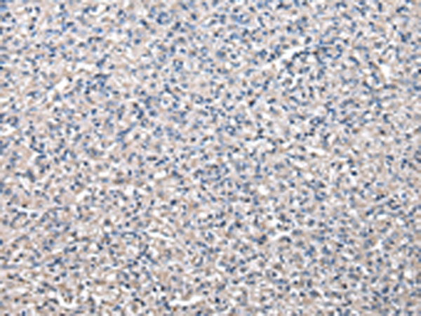 CCT5 Antibody