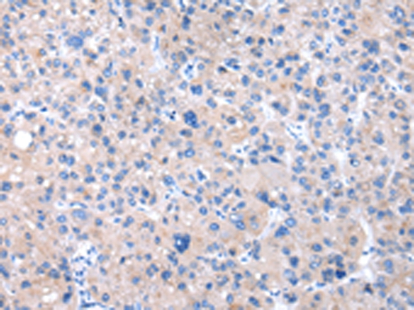 CPM Antibody