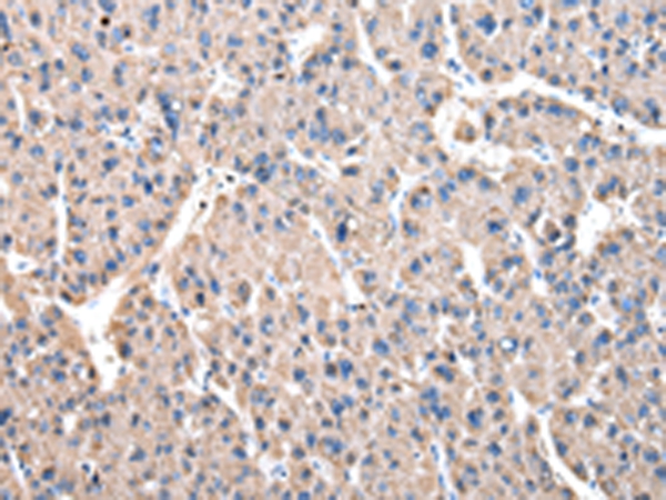 DARS Antibody