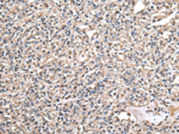 DARS Antibody