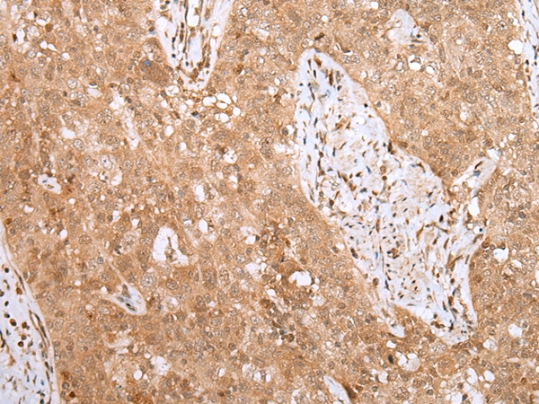 MKI67/ki67 Antibody