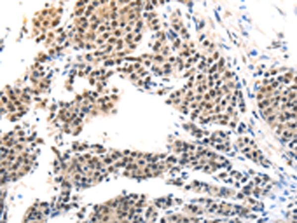 MAGEA6 Antibody