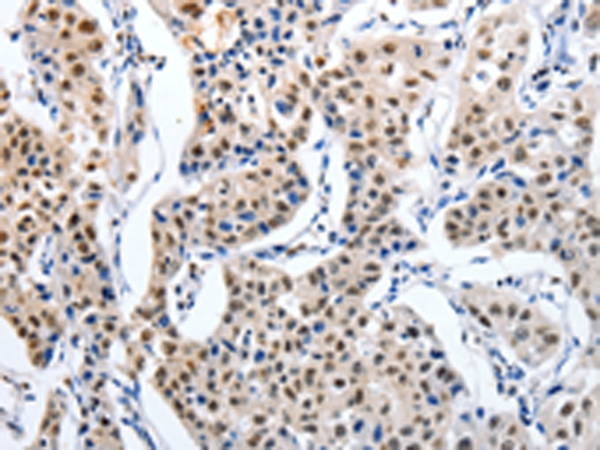 MAGEA6 Antibody