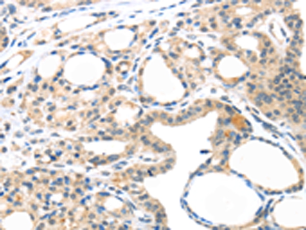 MASP2 Antibody